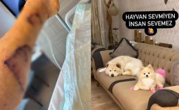 Evdeki diğer köpekten sahibini kıskanarak bacağını parçaladı